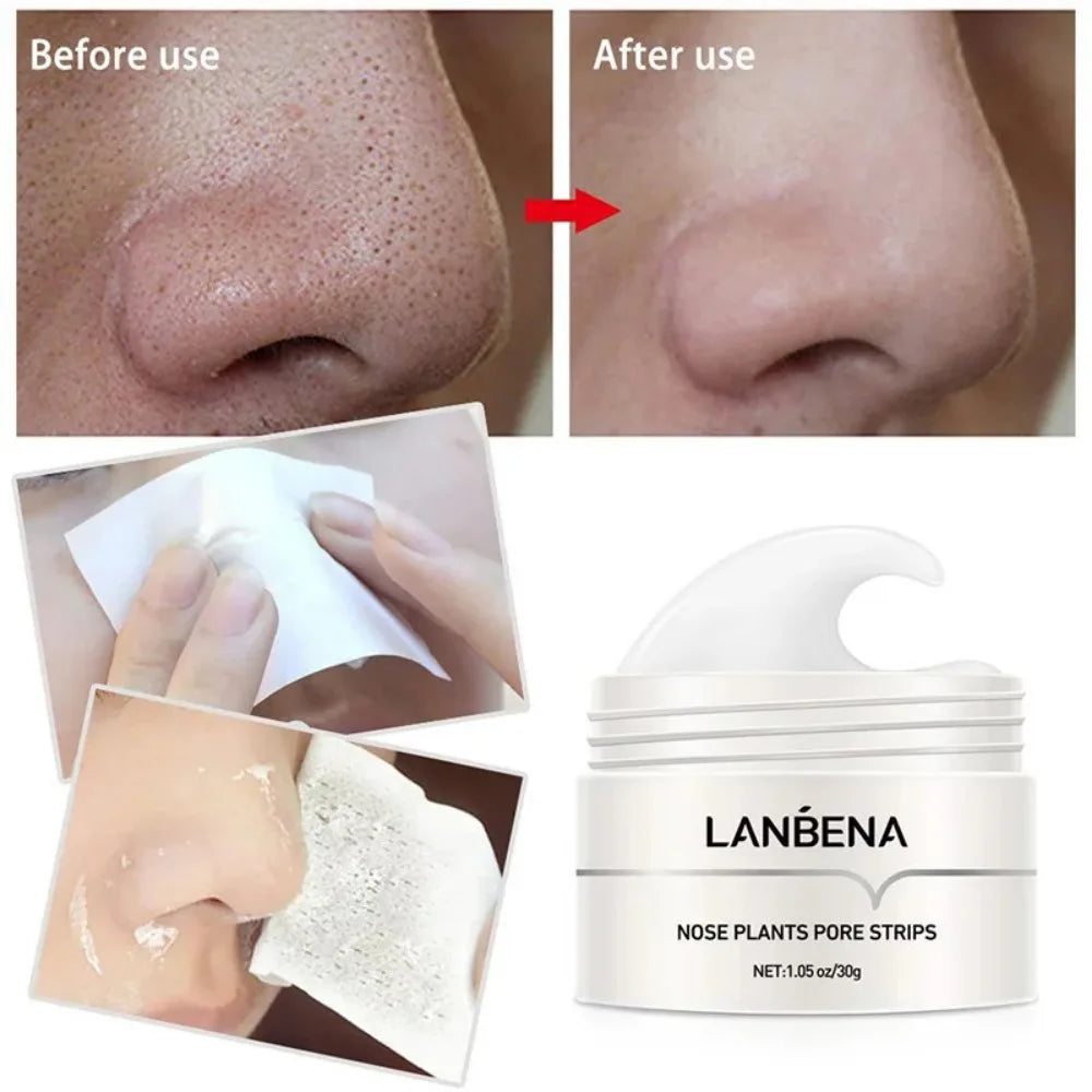 Say Goodbye to Blackheads with Our Deep Cleansing Nose Pore Strip Mask - 30g Cream for Clearer Skin!