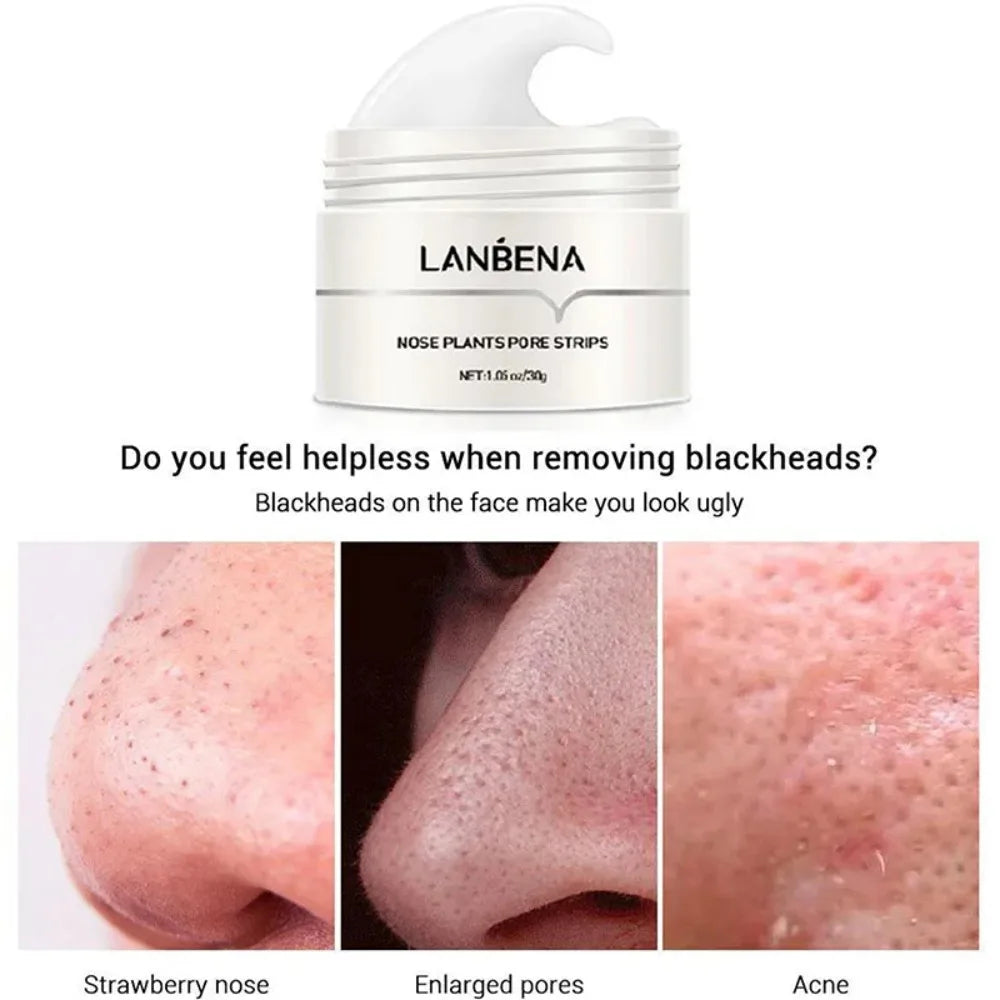 Say Goodbye to Blackheads with Our Deep Cleansing Nose Pore Strip Mask - 30g Cream for Clearer Skin!